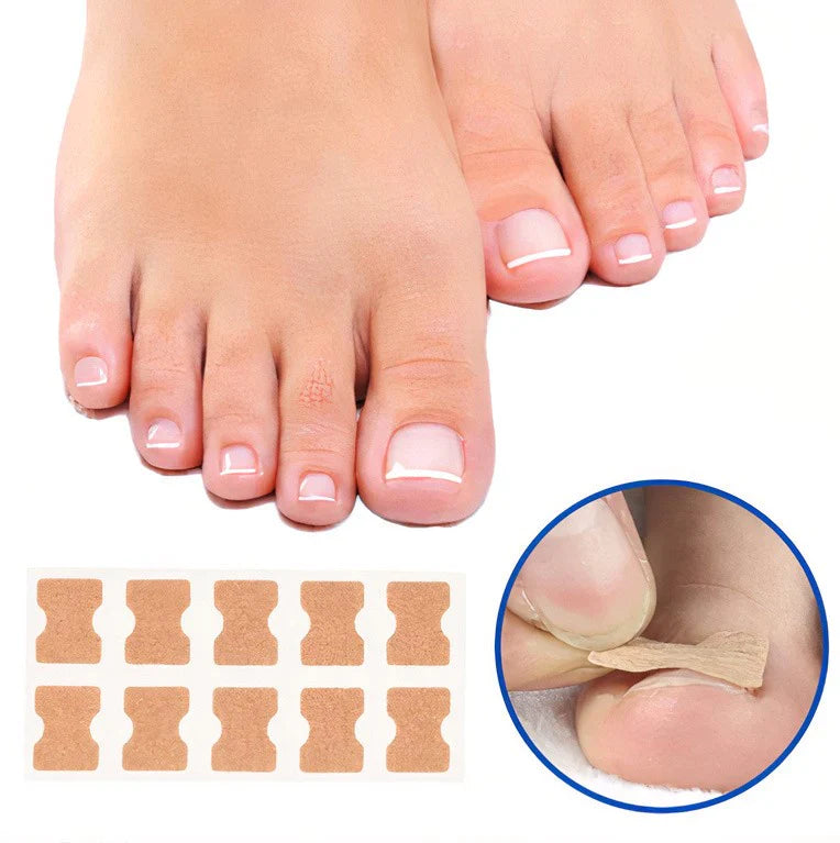Giftzore™ Nail Correction Patches